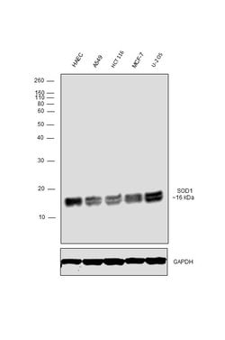 Invitrogen SOD1 Polyclonal Antibody 100 &mu;L; Unconjugated:Antibodies,
