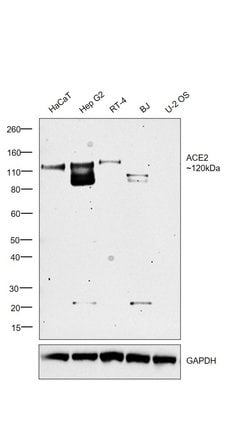 ACE2 Polyclonal Antibody, Invitrogen&trade;
