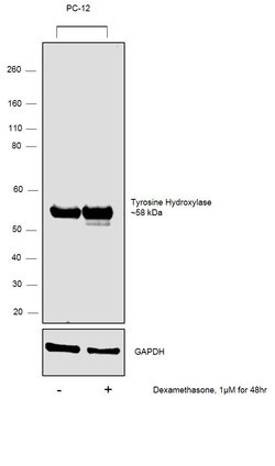 Invitrogen Tyrosine Hydroxylase Polyclonal Antibody 100 &mu;L; Unconjugated:Antibodies,