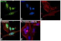 Bcl-10 Polyclonal Antibody, Invitrogen 100 &mu;L; Unconjugated:Antibodies,