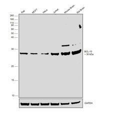 Bcl-10 Polyclonal Antibody, Invitrogen 100 &mu;L; Unconjugated:Antibodies,