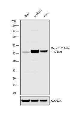 Invitrogen Beta III Tubulin Polyclonal Antibody 100 &mu;L | Buy Online | Invitrogen&trade; | Fisher Scientific