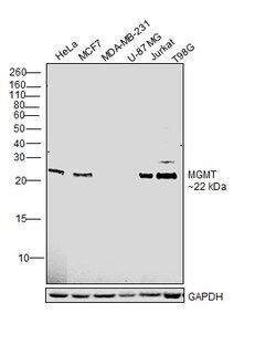 Invitrogen MGMT Polyclonal Antibody 100 &mu;L | Buy Online | Invitrogen&trade; | Fisher Scientific