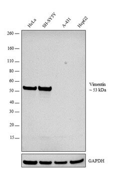 Invitrogen Vimentin Polyclonal Antibody 100 &mu;L; Unconjugated:Antibodies,