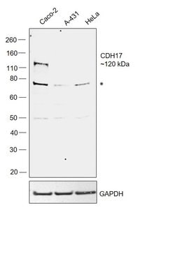 Invitrogen CDH17 Polyclonal Antibody 100 &mu;L; Unconjugated:Antibodies,
