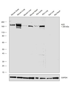 Invitrogen ACE Polyclonal Antibody 100 &mu;L; Unconjugated:Antibodies,