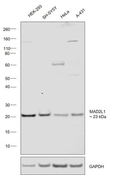 MAD2 Polyclonal Antibody:Antibodies, Polyclonal