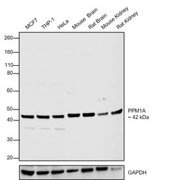Invitrogen PPM1A Polyclonal Antibody 100 &mu;L; Unconjugated:Antibodies,