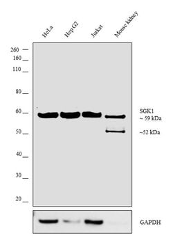 Invitrogen SGK1 Polyclonal Antibody 100 &mu;L; Unconjugated:Antibodies,
