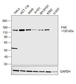 Invitrogen FAK Polyclonal Antibody 100 &mu;L; Unconjugated:Antibodies,