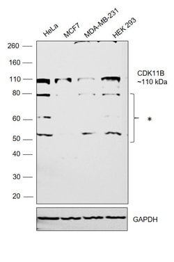 Invitrogen CDK11B Polyclonal Antibody 100 &mu;L | Buy Online | Invitrogen&trade; | Fisher Scientific