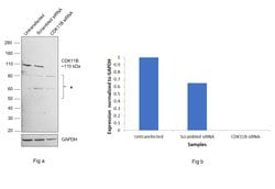 Invitrogen CDK11B Polyclonal Antibody 100 &mu;L | Buy Online | Invitrogen&trade; | Fisher Scientific