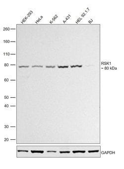 Invitrogen RSK1 Polyclonal Antibody 100 &mu;L; Unconjugated:Antibodies,