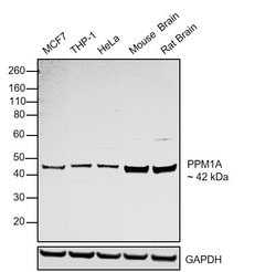 Invitrogen PPM1A Polyclonal Antibody 100 &mu;L; Unconjugated:Antibodies,