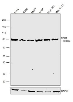 Invitrogen RSK1 Polyclonal Antibody 100 &mu;g | Buy Online | Invitrogen&trade; | Fisher Scientific