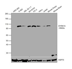 Invitrogen DYRK1A Polyclonal Antibody 100 &mu;g; Unconjugated:Antibodies,