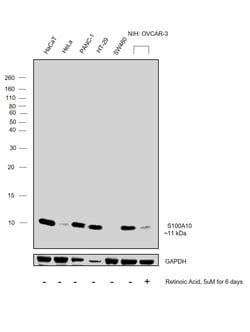 Invitrogen S100A10 Polyclonal Antibody 100 &mu;g; Unconjugated:Antibodies,