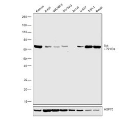 Invitrogen Syk Polyclonal Antibody 100 &mu;L | Buy Online | Invitrogen&trade; | Fisher Scientific