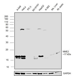 Invitrogen NME2 Polyclonal Antibody 100 &mu;L; Unconjugated:Antibodies,