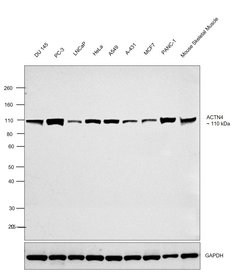 Invitrogen eIF3d Polyclonal Antibody 100 &mu;g; Unconjugated:Antibodies,