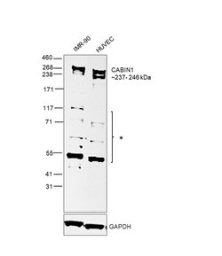 Invitrogen CABIN1 Polyclonal Antibody 100 &mu;g; Unconjugated:Antibodies,