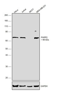 PARP2 Polyclonal Antibody:Antibodies, Polyclonal