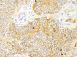 PABP4 Polyclonal Antibody, Bethyl Laboratories 10 &mu;L; Unconjugated:Antibodies,