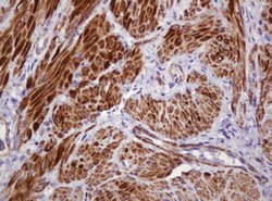 PADI4 Mouse anti-Human, Clone: OTI5C10, lyophilized, TrueMAB 100 &mu;g;