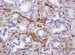 PADI4 Mouse anti-Human, Clone: OTI5C10, lyophilized, TrueMAB 100 &mu;g;