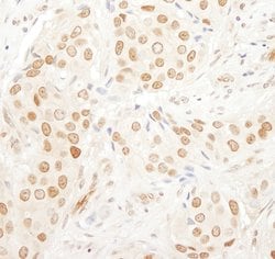 PAF49 Rabbit anti-Human, Polyclonal, Bethyl Laboratories 100 &mu;L; Unconjugated:Antibodies,