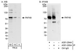 PAF49 Rabbit anti-Human, Polyclonal, Bethyl Laboratories 100 &mu;L; Unconjugated:Antibodies,