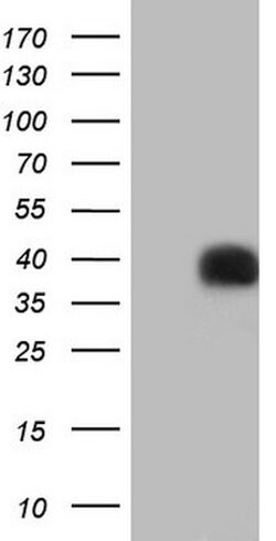 PAGE1 Mouse anti-Human, Clone: OTI4A6, lyophilized, TrueMAB 100 &mu;g;