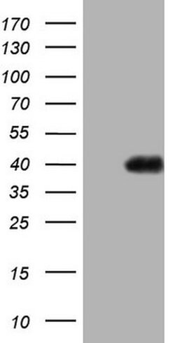 PAGE1 Mouse anti-Human, Clone: OTI13B1, lyophilized, TrueMAB 100 &mu;g;