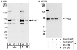 PAK2 Rabbit anti-Human, Mouse, Polyclonal, Bethyl Laboratories 100 &mu;L;