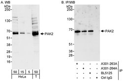 PAK2 Rabbit anti-Human, Polyclonal, Bethyl Laboratories 100 &mu;L; Unconjugated:Antibodies,