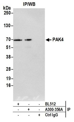 PAK4 Rabbit anti-Human, Polyclonal, Bethyl Laboratories 100 &mu;L; Unconjugated:Antibodies,