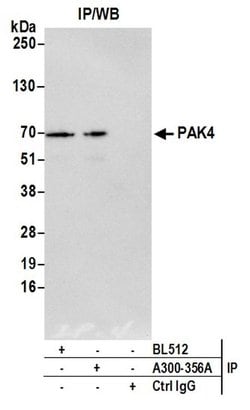 PAK4 Rabbit anti-Human, Polyclonal, Bethyl Laboratories 10 &mu;L; Unconjugated:Antibodies,