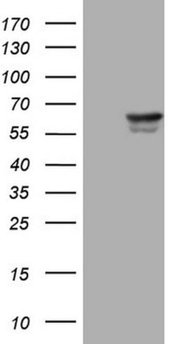 PAK4 Mouse anti-Human, Clone: OTI3C3, lyophilized, TrueMAB 100 &mu;g; Unconjugated:Antibodies,
