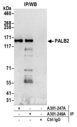 PALB2 Rabbit anti-Human, Polyclonal, Bethyl Laboratories 100 &mu;L; Unconjugated:Antibodies,
