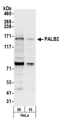 PALB2 Rabbit anti-Human, Polyclonal, Bethyl Laboratories 20 &mu;L; Unconjugated:Antibodies,