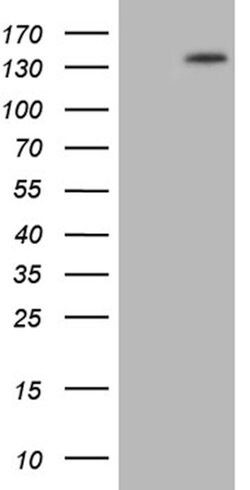 PALB2 Mouse anti-Human, Clone: OTI1E7, lyophilized, TrueMAB 100 &mu;g;