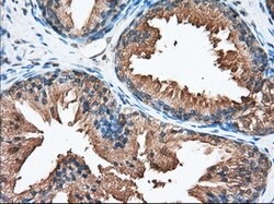 PANK2 Mouse anti-Canine, Human, Rat, Clone: OTI3H9, lyophilized, TrueMAB