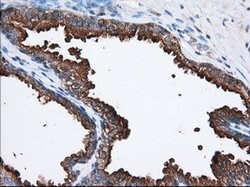 PANK2 Mouse anti-Canine, Human, Rat, Clone: OTI3H9, lyophilized, TrueMAB