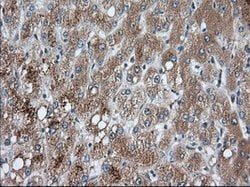 PANK2 Mouse anti-Canine, Human, Rat, Clone: OTI3H9, lyophilized, TrueMAB