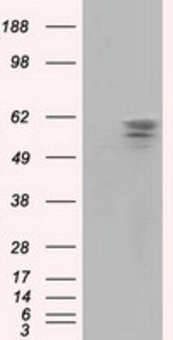 PANK2 Mouse anti-Canine, Human, Rat, Clone: OTI3H9, lyophilized, TrueMAB