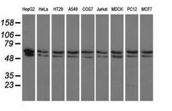 PANK2 Mouse anti-Canine, Human, Rat, Clone: OTI3H9, lyophilized, TrueMAB