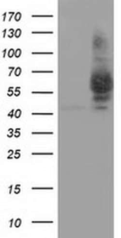 PANK2 Monoclonal Antibody (OTI4B3), TrueMAB , OriGene 100 &mu;L; Unconjugated:Antibodies,