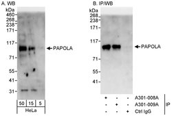 PAPOLA Rabbit anti-Human, Polyclonal, Bethyl Laboratories 100 &mu;L; Unconjugated:Antibodies,