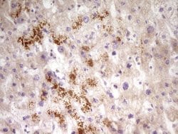 PAPSS2 Monoclonal Antibody (OTI3H10), TrueMAB , OriGene 100 &mu;L; Unconjugated:Antibodies,