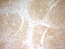 PAPSS2 Monoclonal Antibody (OTI7E8), TrueMAB , OriGene 100 &mu;L; Unconjugated:Antibodies,